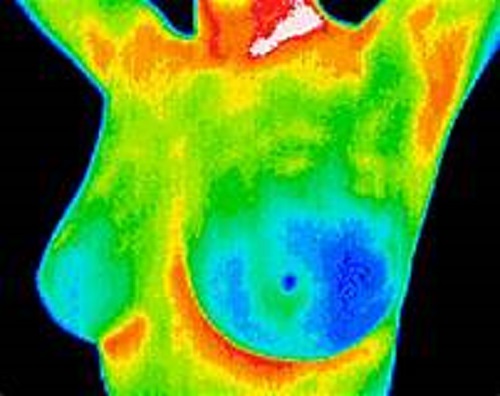 digital thermography